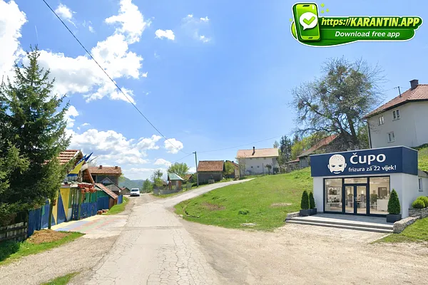 Na Slivnu otvorena Klinika za transplantaciju Kose!